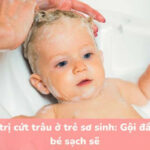 Ảnh cứt trâu trên đầu trẻ sơ sinh, mảng bám màu vàng