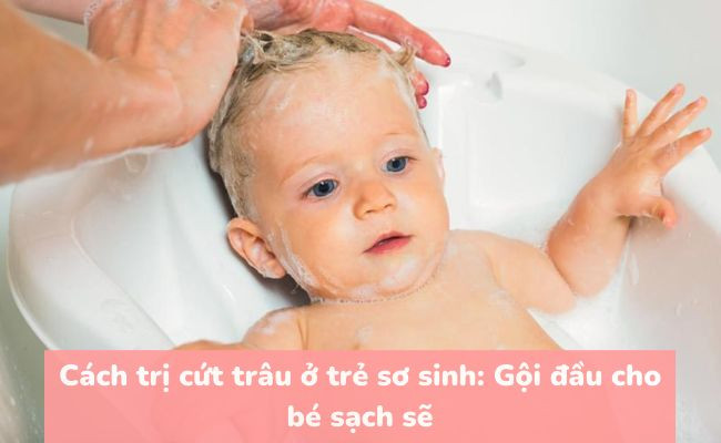 Ảnh cứt trâu trên đầu trẻ sơ sinh, mảng bám màu vàng