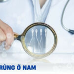 Hình ảnh minh họa vô tinh ở nam giới, tập trung vào ống sinh tinh và quá trình sản xuất tinh trùng